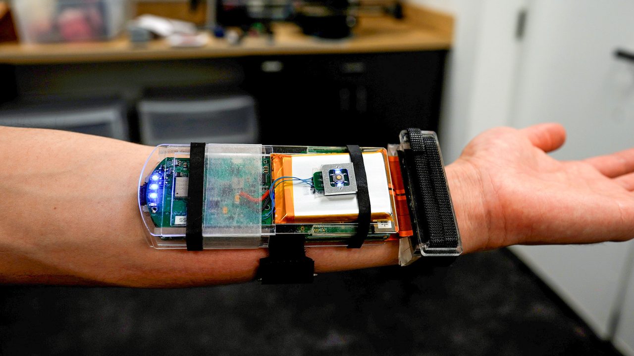 Ultrason görüntüleme robot elleri daha becerikli kılıyor